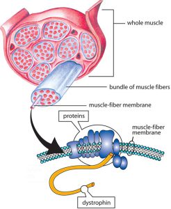 Becker syndrome