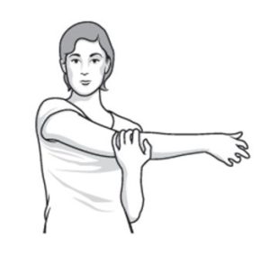 frozen shoulder