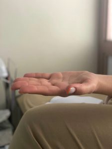 سندروم تونل کارپال 