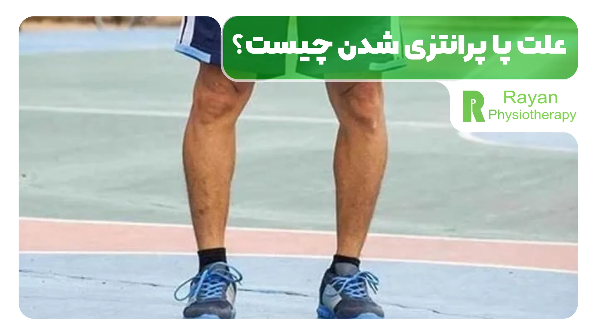علت پا پرانتزی شدن چیست؟