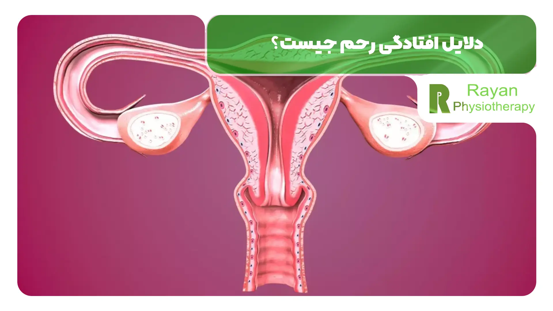 دلایل افتادگی رحم جیست؟