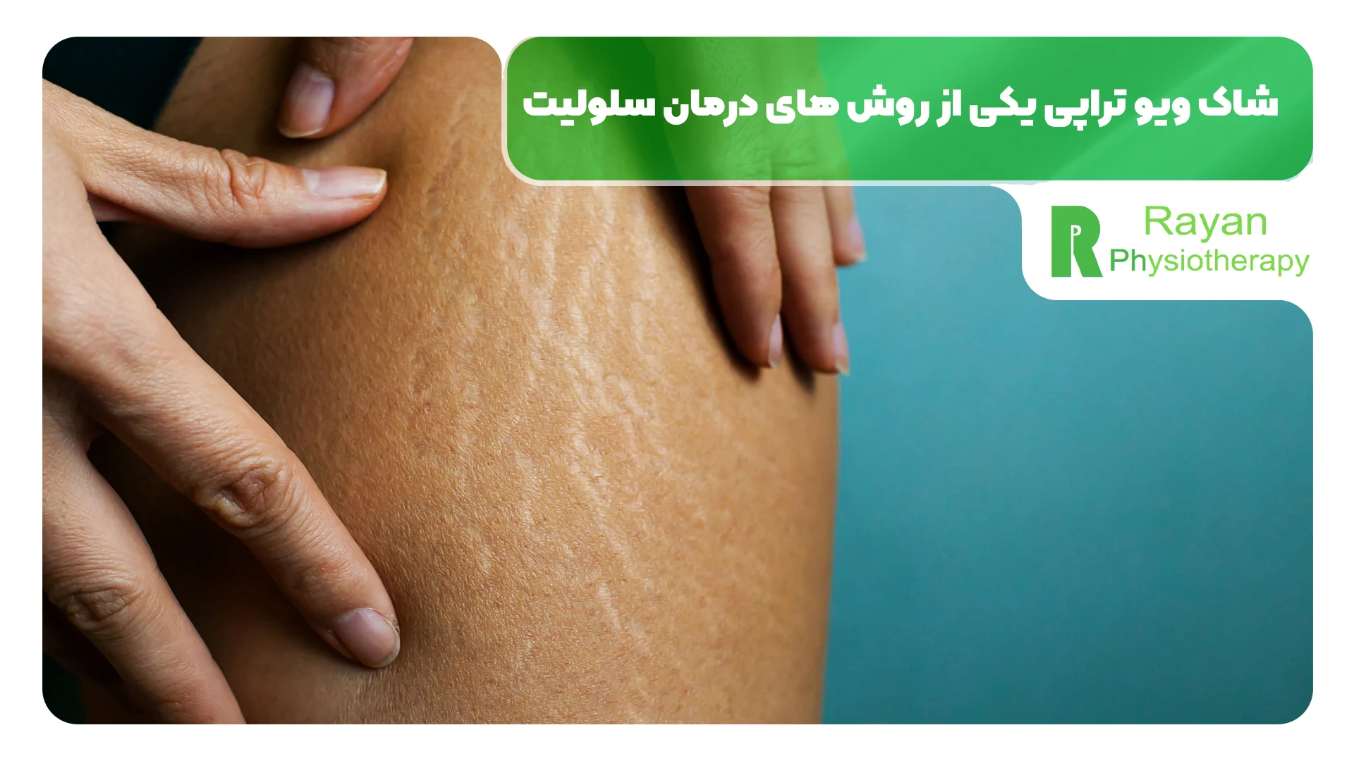 درمان سلولیت با دستگاه شاک ویو تراپی