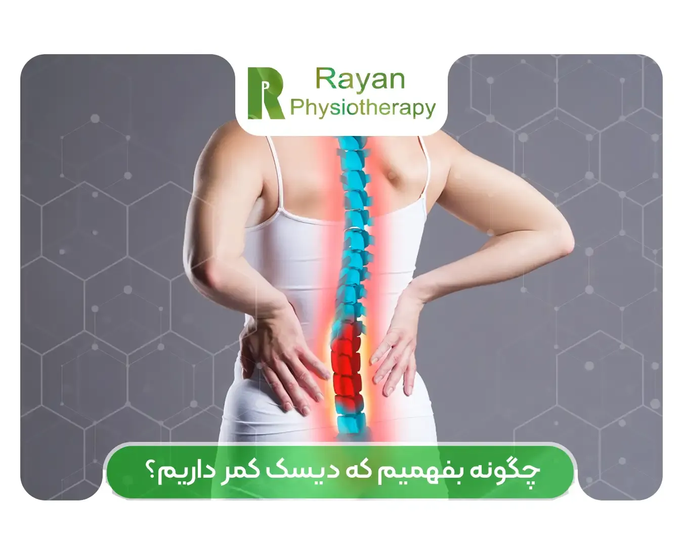 علائم دیسک کمر چیست؟