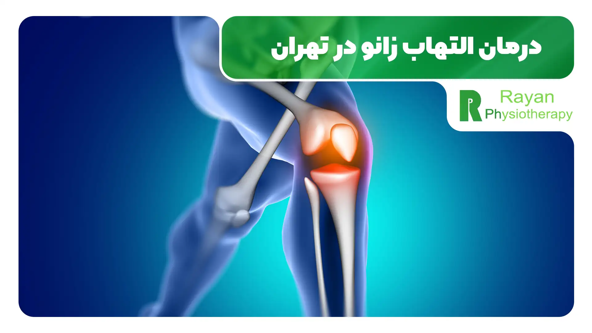التهاب یا آب آوردن زانو چیست و چه درمانی دارد؟