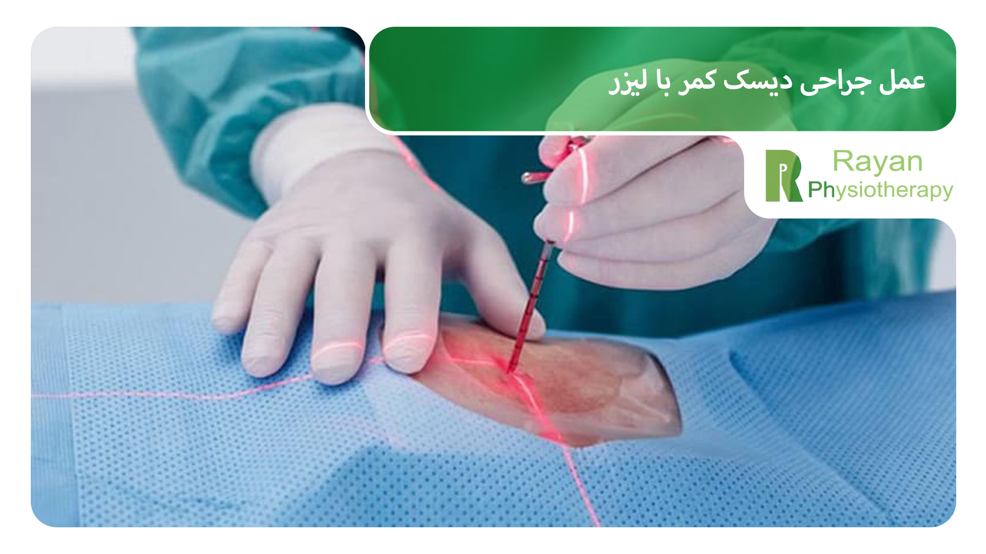 عمل جراحی دیسک کمر با لیزر