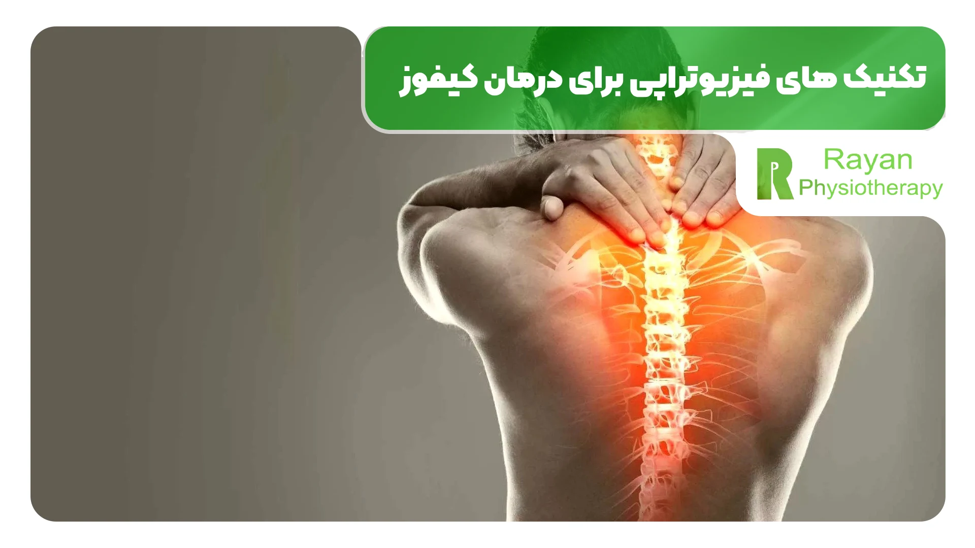 تکنیک های فیزیوتراپی برای درمان کیفوز