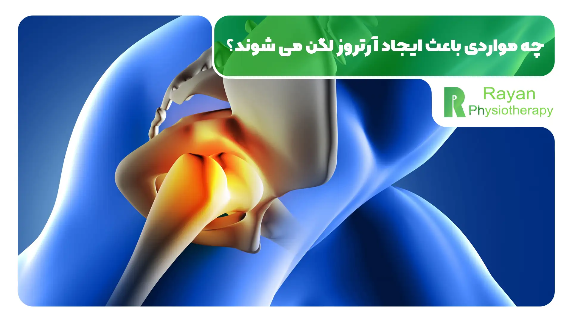 فیزیوتراپی آرتروز لگن چیست و چه فوایدی دارد؟