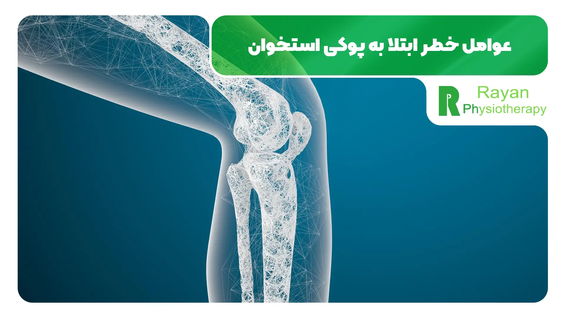 پیشگیری از پوکی استخوان