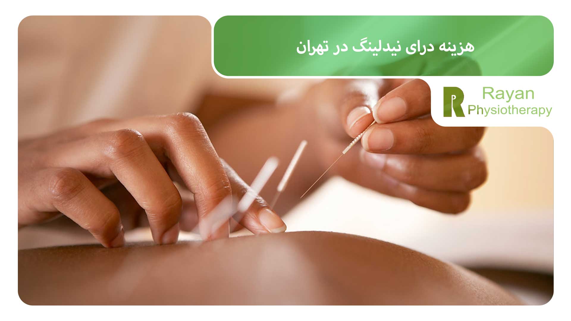 هزینه درای نیدلینگ در تهران