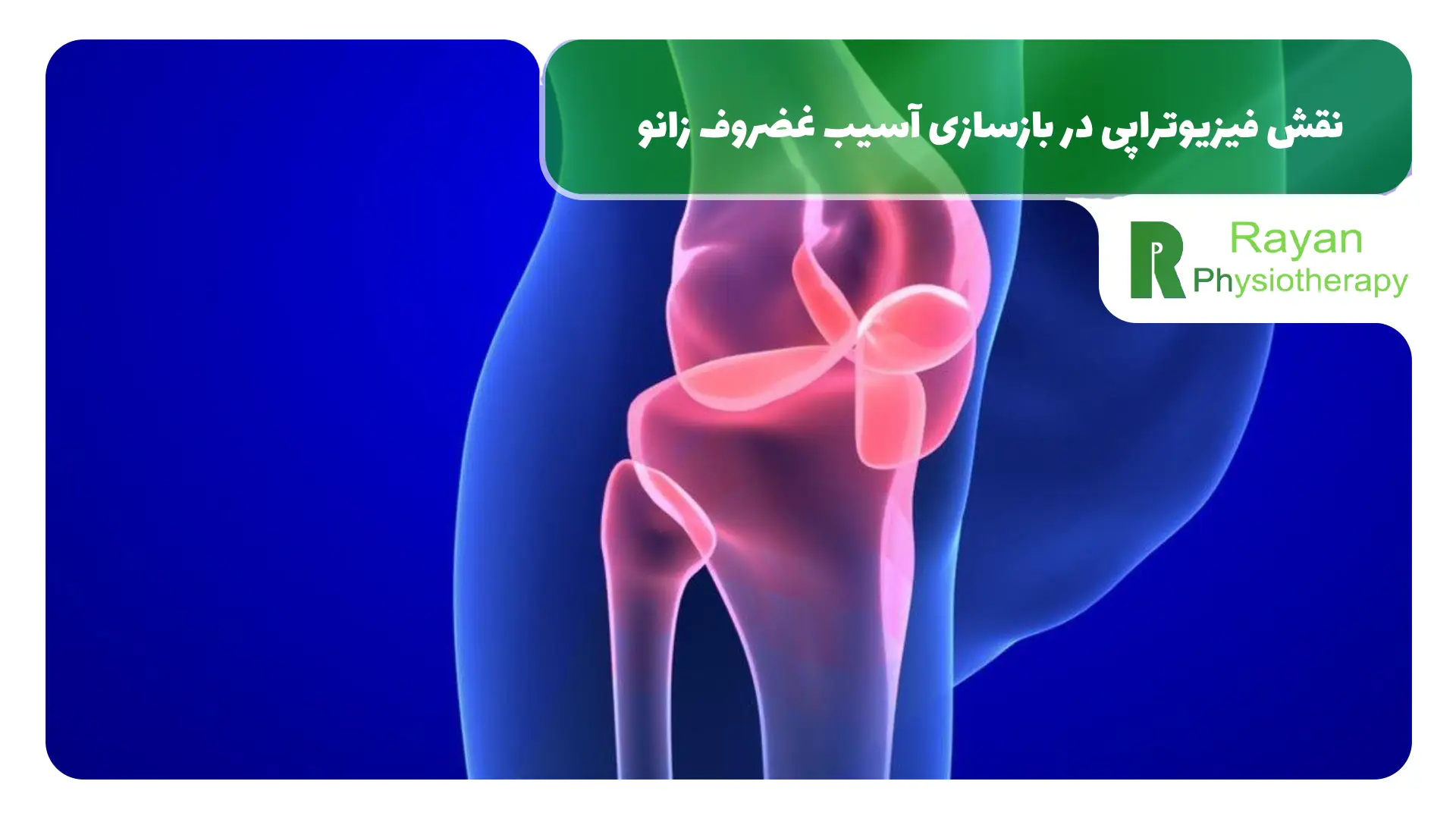 نقش فیزیوتراپی در بازسازی آسیب غضروف زانو