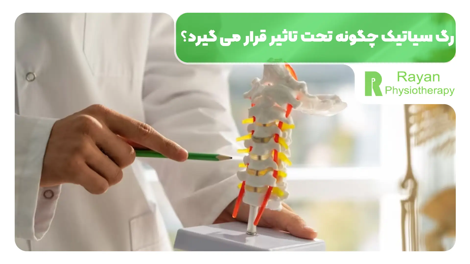 رگ سیاتیک چگونه تحت تاثیر قرار می گیرد؟