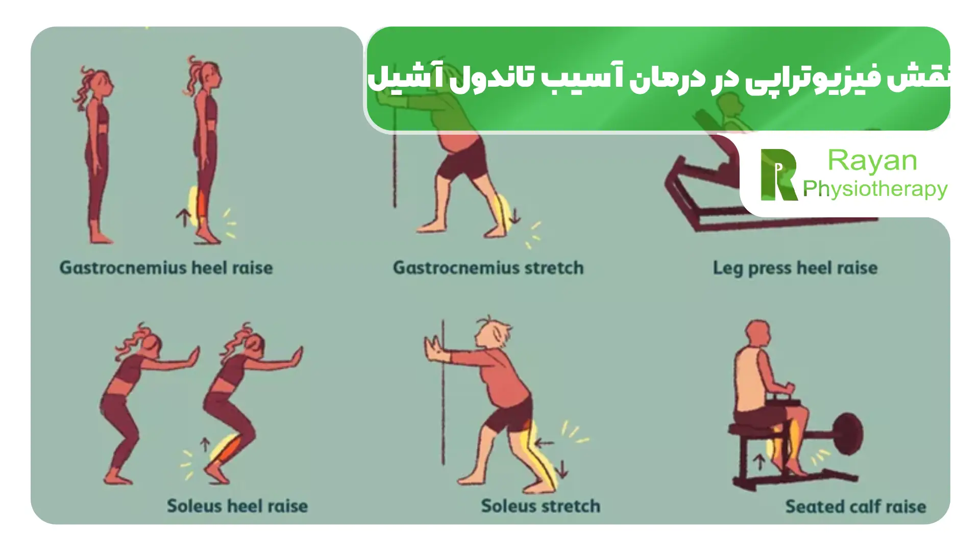 نقش فیزیوتراپی در درمان آسیب تاندول آشیل