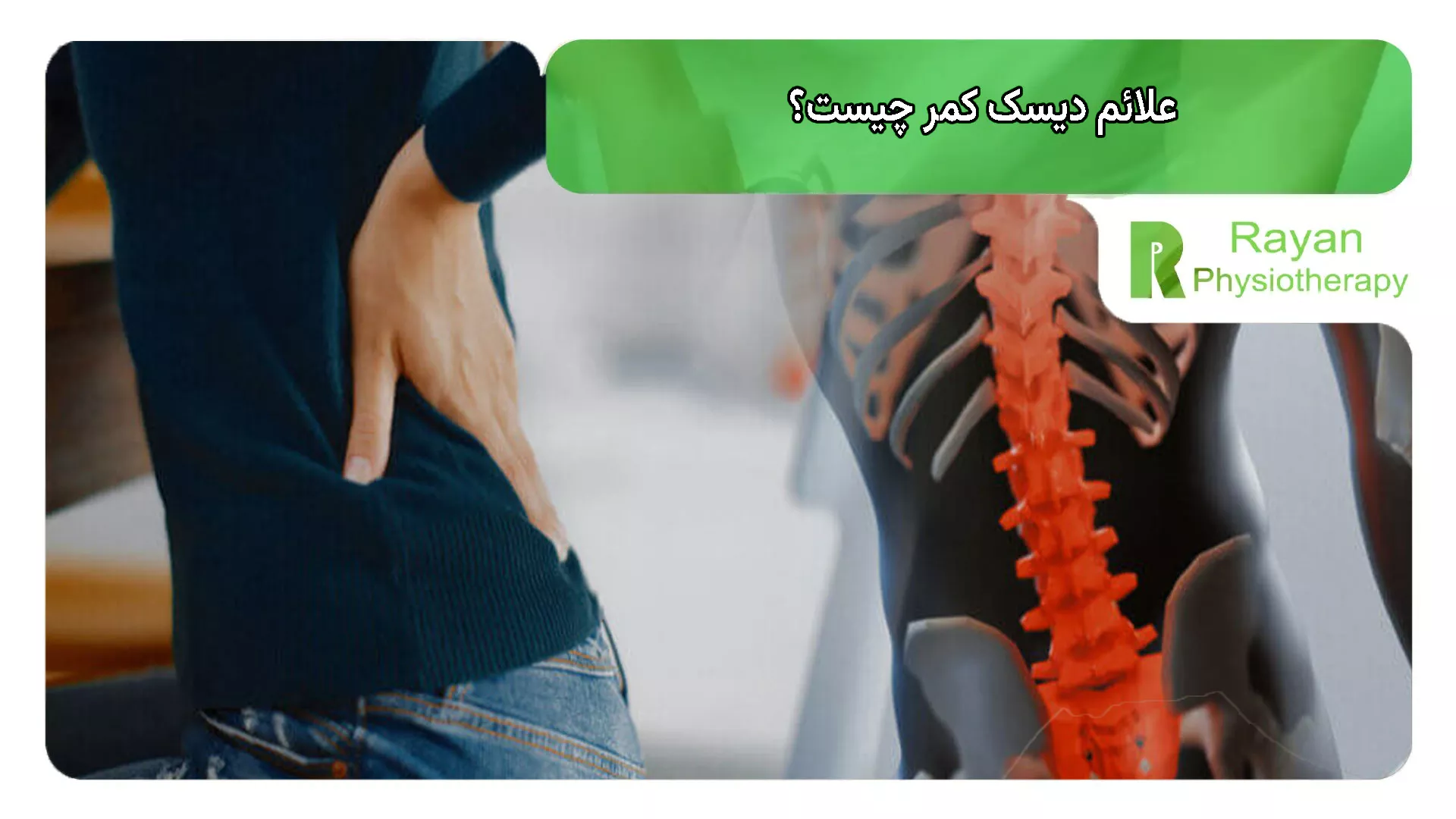 علائم دیسک کمر چیست؟