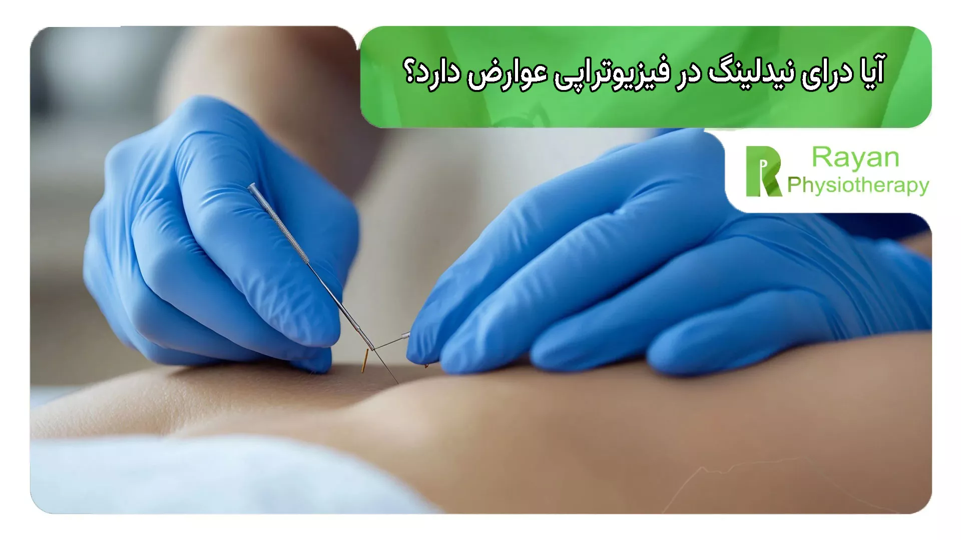 آیا درای نیدلینگ در فیزیوتراپی عوارض دارد؟
