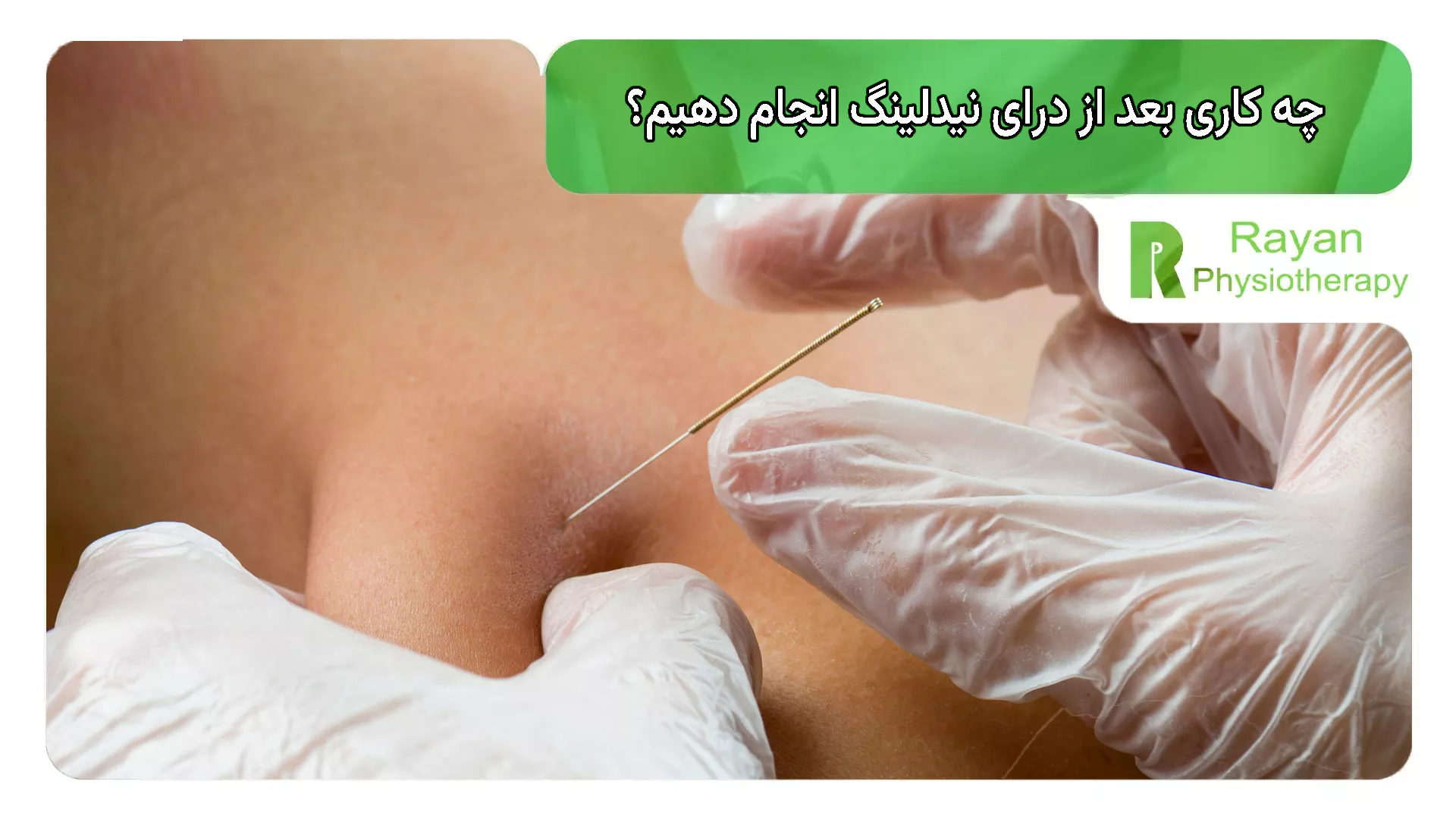 چه کاری بعد از درای نیدلینگ انجام دهیم؟