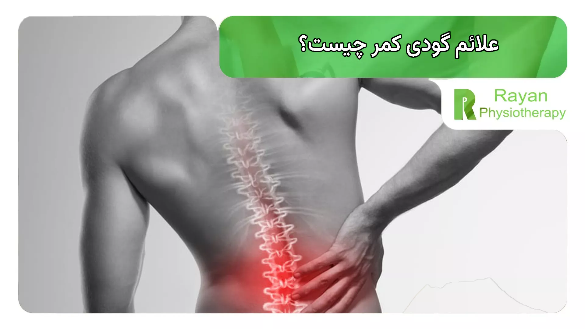 علائم گودی کمر چیست؟