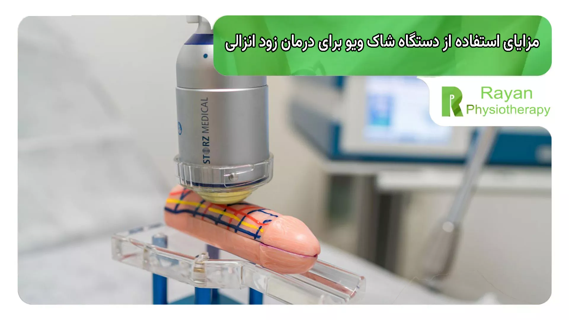 مزایای استفاده از دستگاه شاک ویو برای درمان زود انزالی
