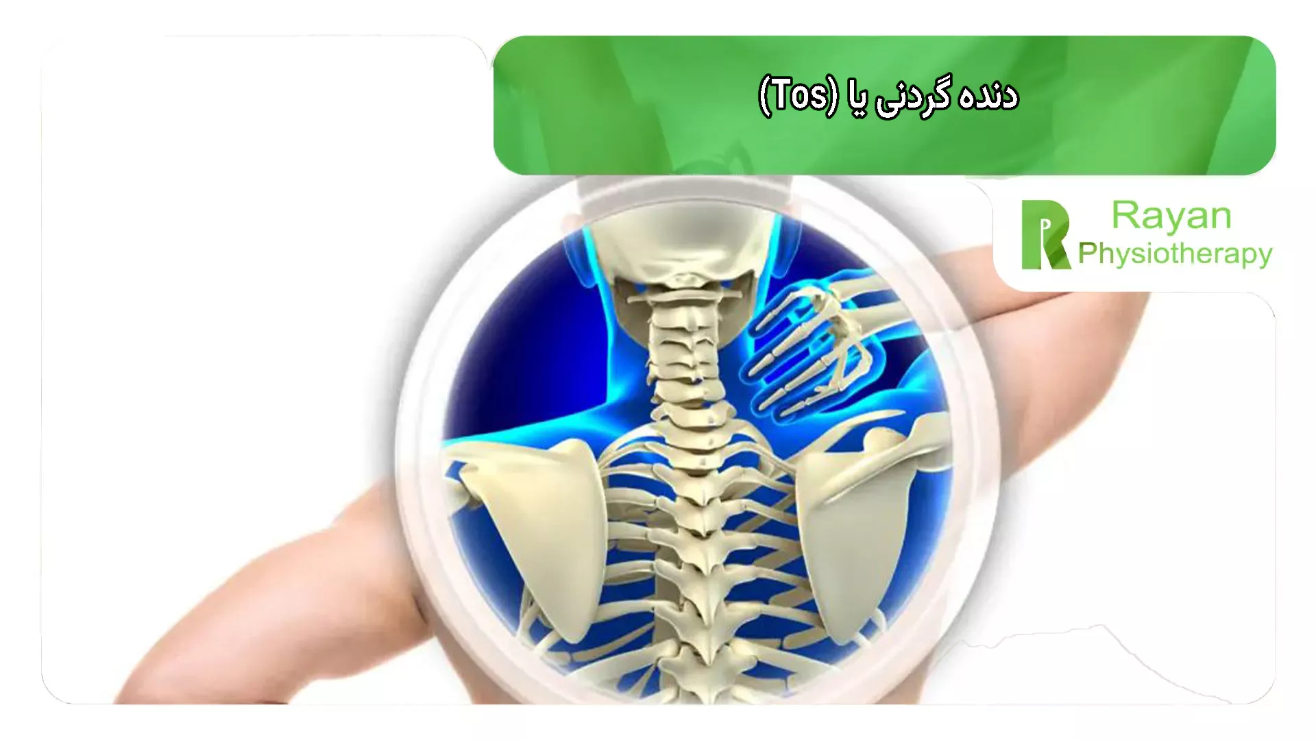 دنده گردنی یا (Tos)