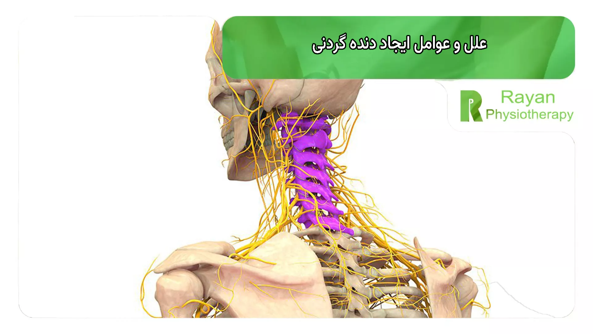 علل و عوامل ایجاد دنده گردنی