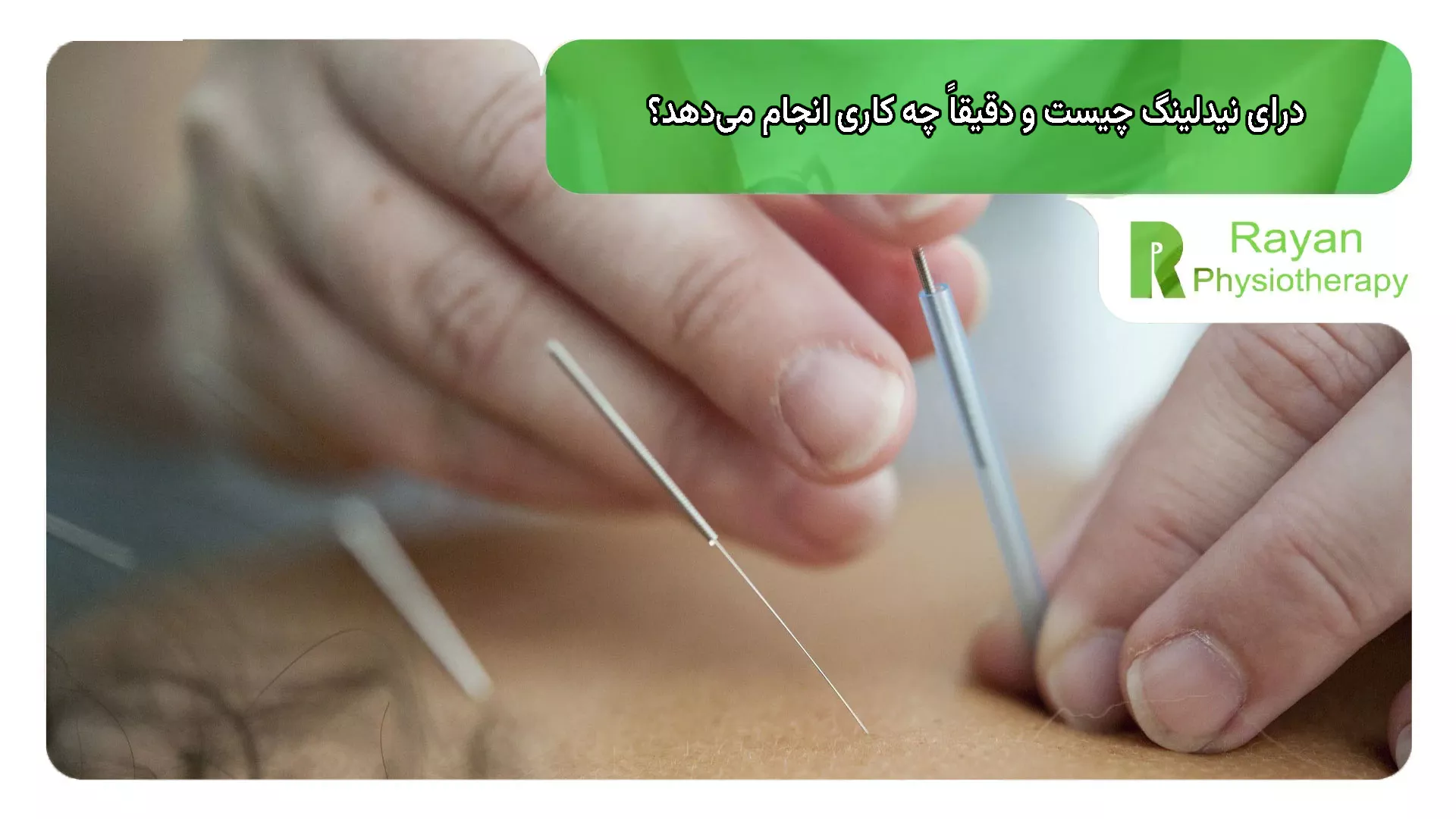 درای نیدلینگ چیست و دقیقاً چه کاری انجام میدهد؟