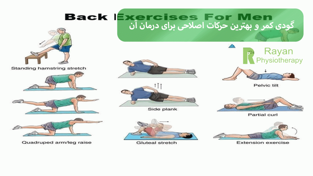 گودی کمر و بهترین حرکات اصلاحی برای درمان آن