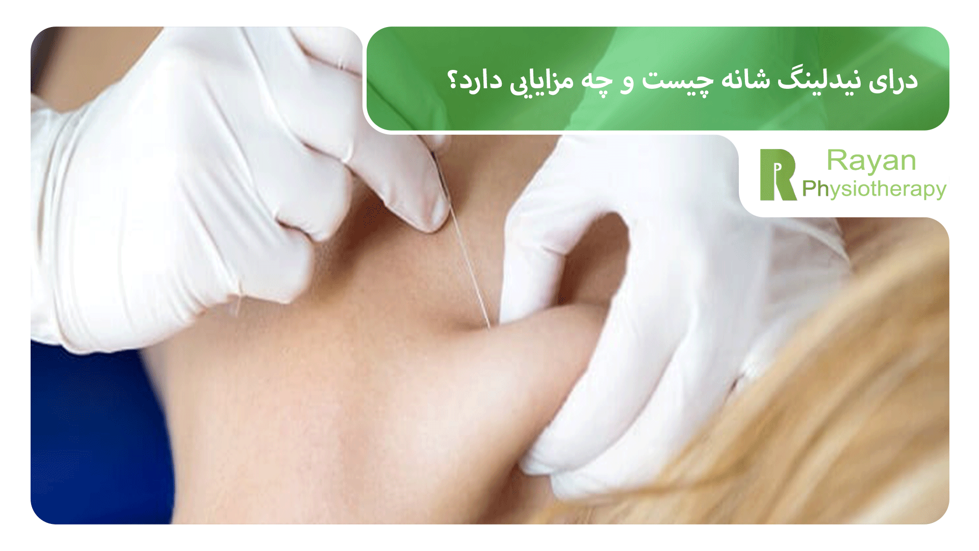درای نیدلینگ شانه چیست و چه مزایایی دارد؟