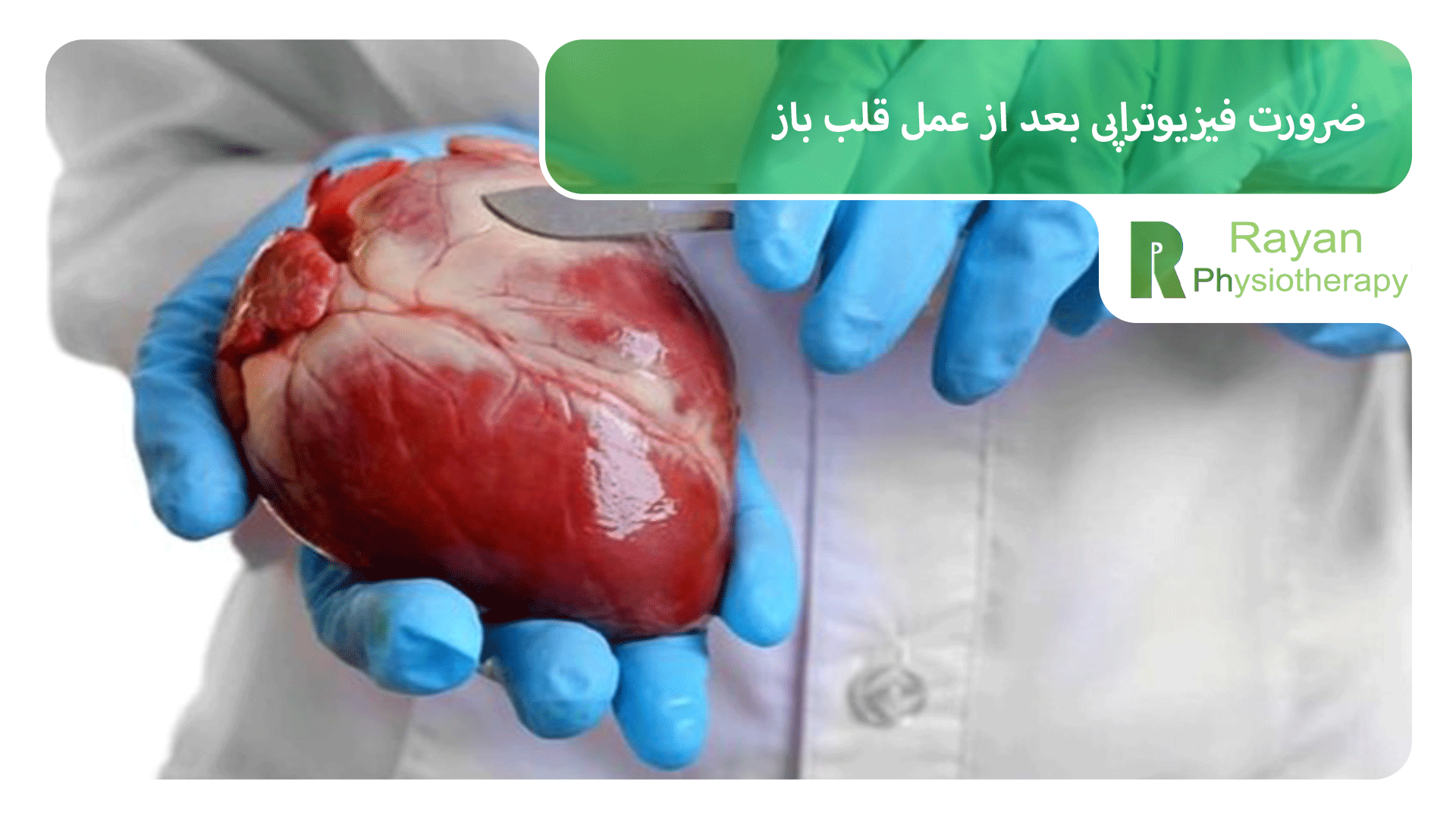ضرورت فیزیوتراپی بعد از عمل قلب باز