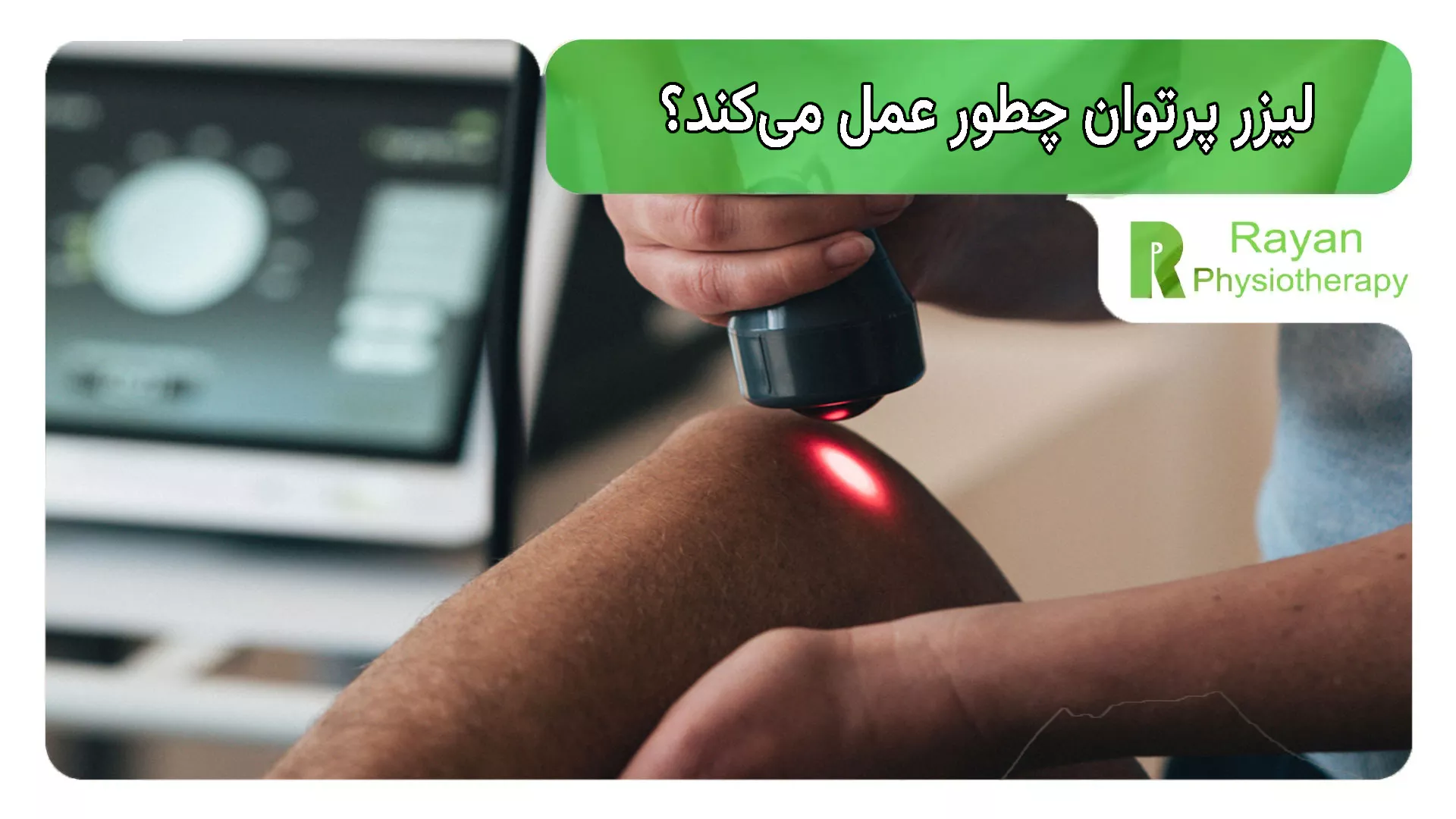 لیزر پرتوان چطور عمل می‌کند؟