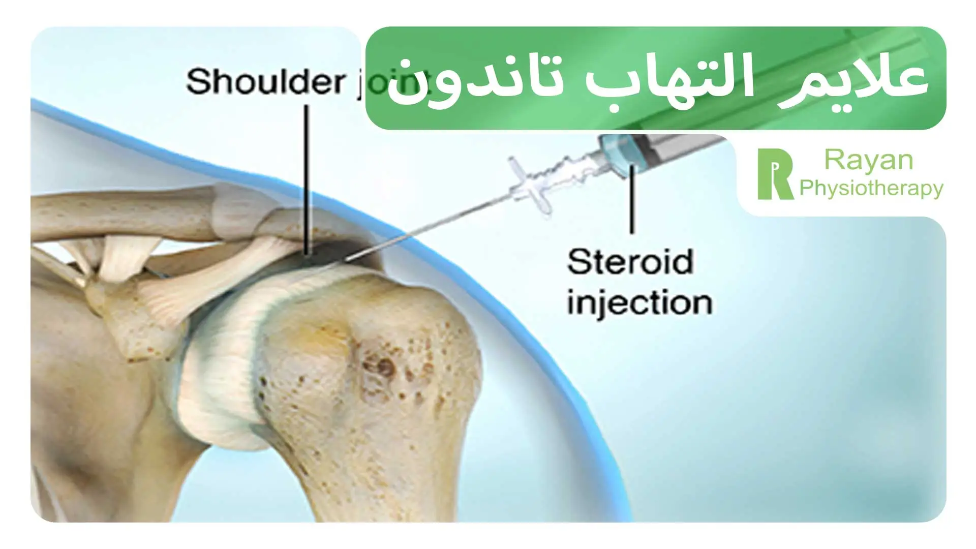 علایم التهاب تاندون