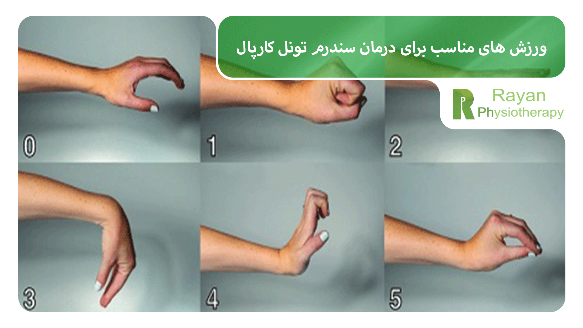 راهنمای جامع تمرینات ورزشی برای سندرم تونل کارپال