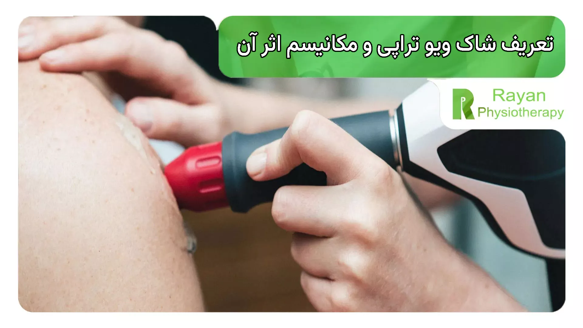 تعریف شاک ویو تراپی و مکانیسم اثر آن
