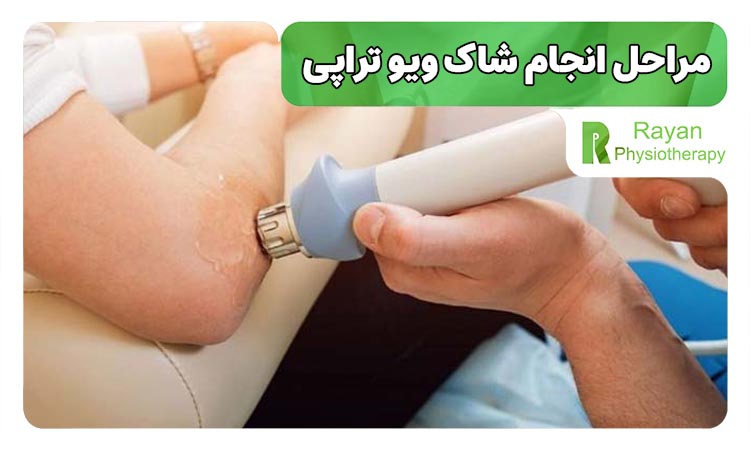 مراحل انجام شاک ویو تراپی 