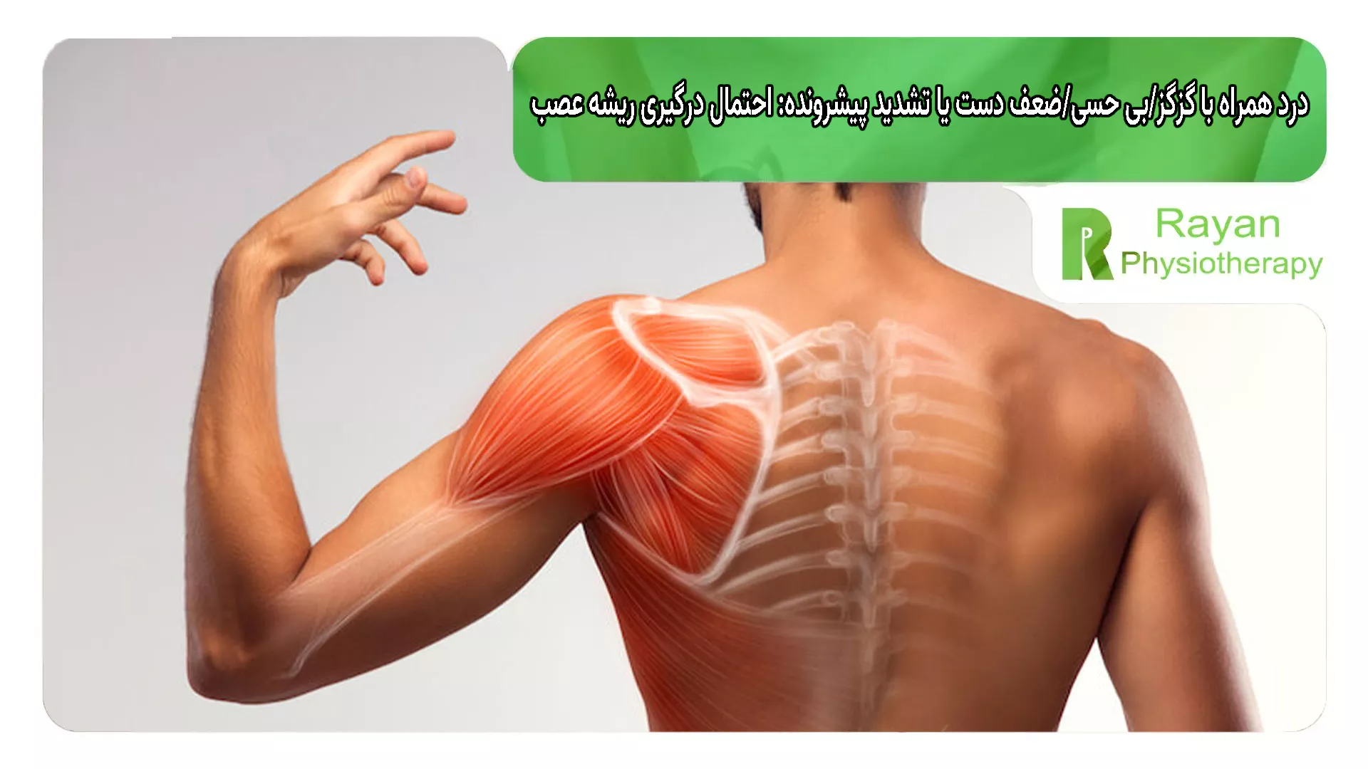 درد همراه با گزگز/بی حسی/ضعف دست یا تشدید پیشرونده: احتمال درگیری ریشه عصب