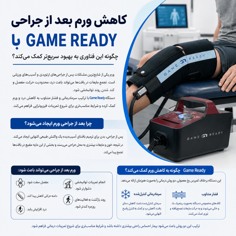 کاهش ورم بعد از جراحی با Game Ready | مزایا، نحوه عملکرد و نقش آن در توانبخشی