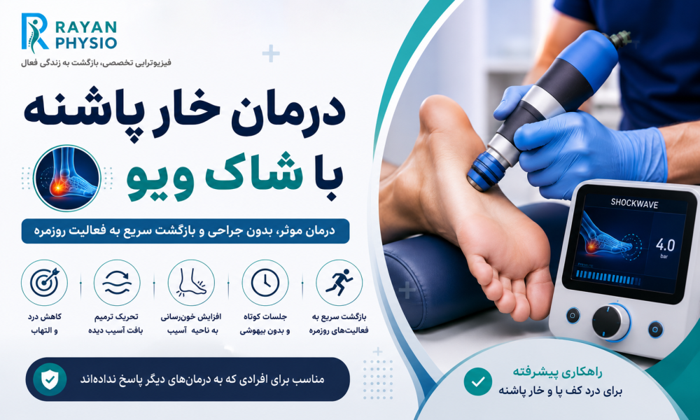 درمان خار پاشنه با شاک ویو | راهنمای کامل درمان بدون جراحی