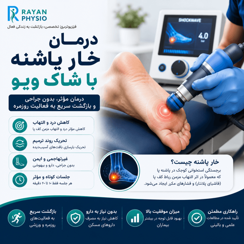 درمان خار پاشنه با شاک ویو | راهنمای کامل درمان بدون جراحی