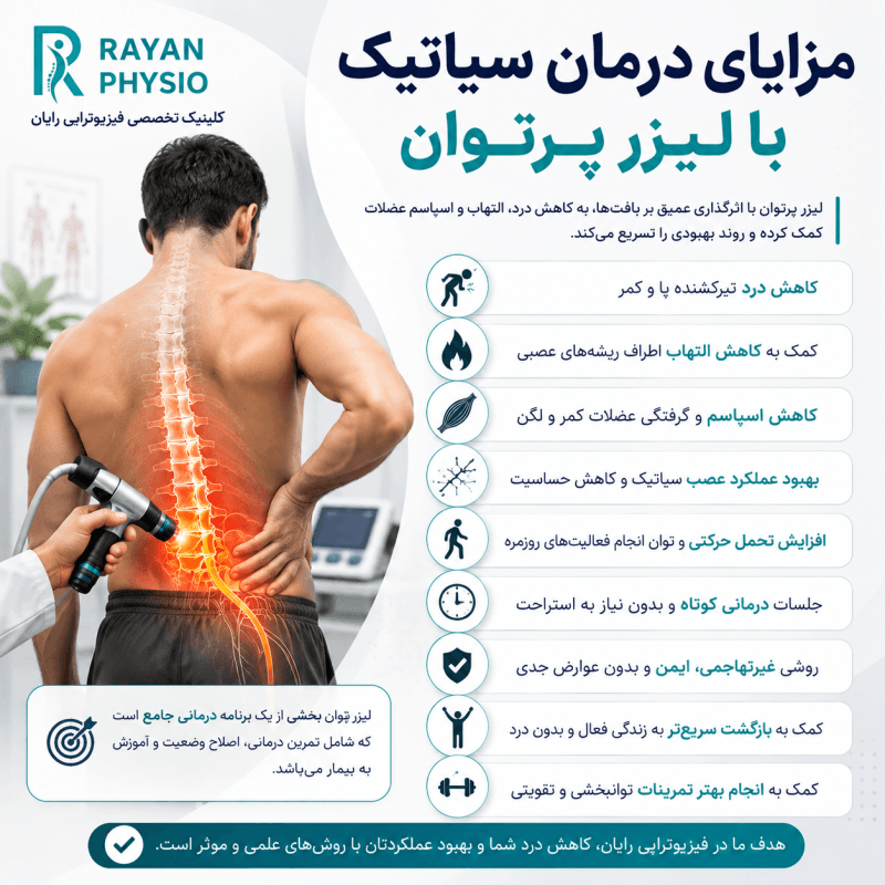درمان سیاتیک با لیزر پرتوان؛ مزایا، نحوه درمان و تعداد جلسات