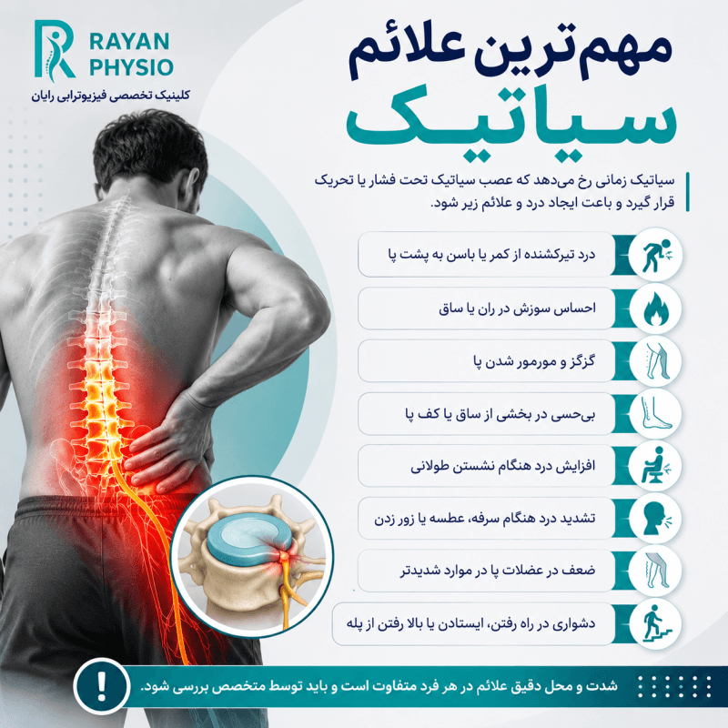 درمان سیاتیک با لیزر پرتوان؛ مزایا، نحوه درمان و تعداد جلسات